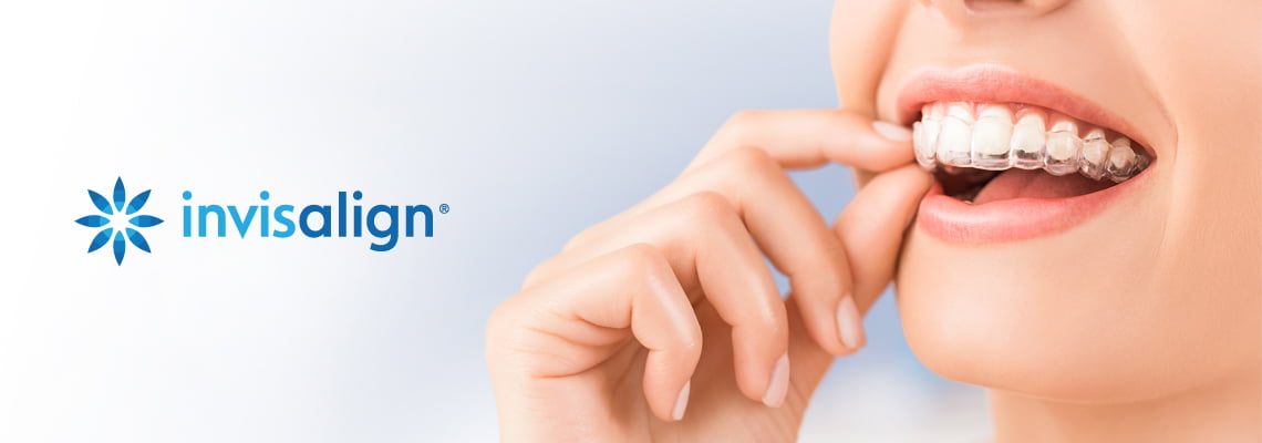 Clear Aligners (Invisalign)