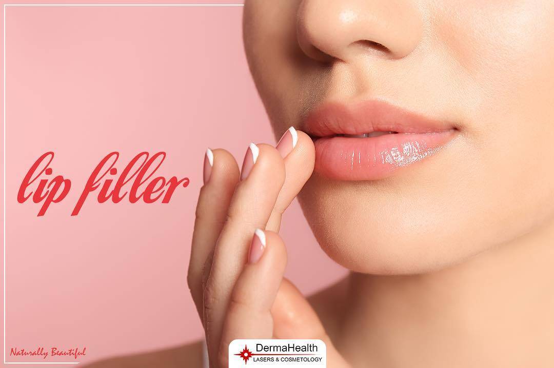 Lip Filler Offer
