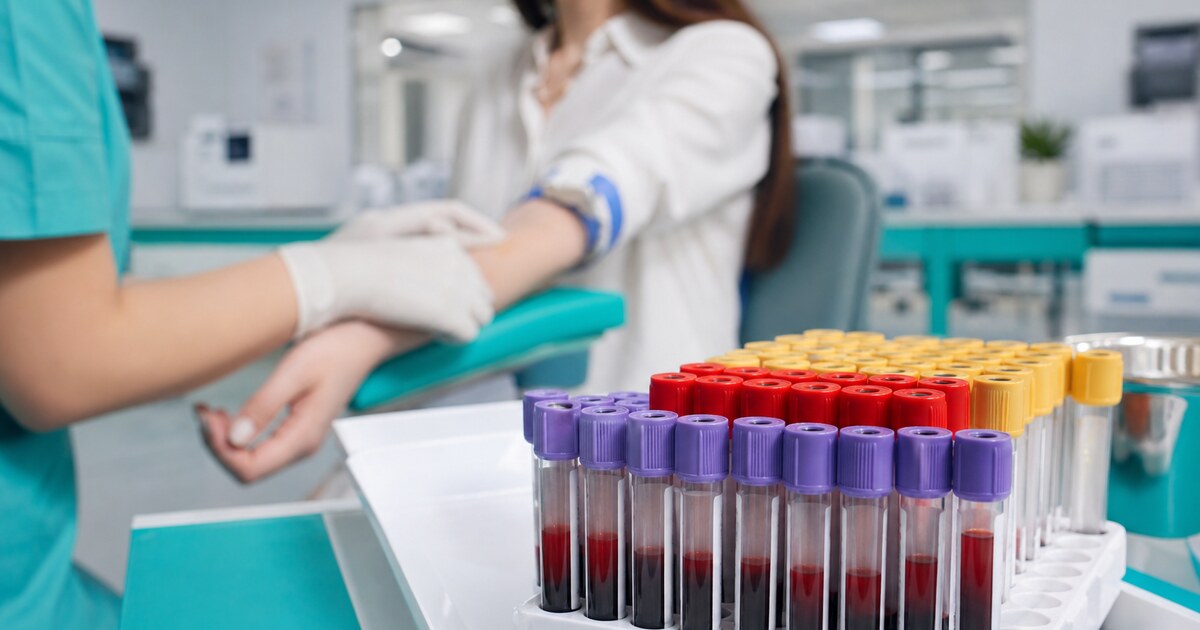 Understanding Blood Test Results: A Guide to Common Lab Values